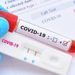 BRZI ANTIGENSKI TESTOVI NA COVID-19 I COVID PUTOVNICE